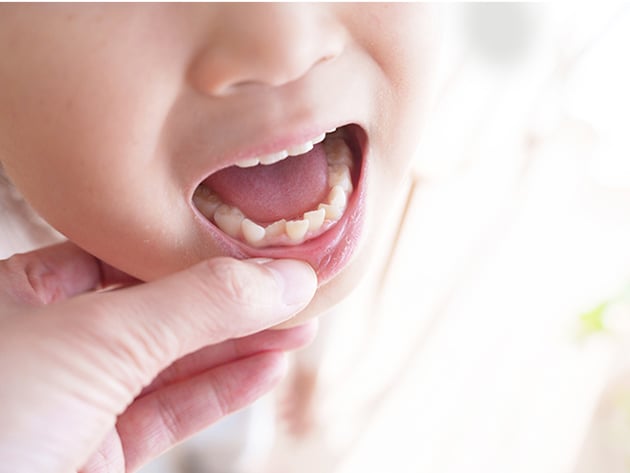 子どもの歯の写真